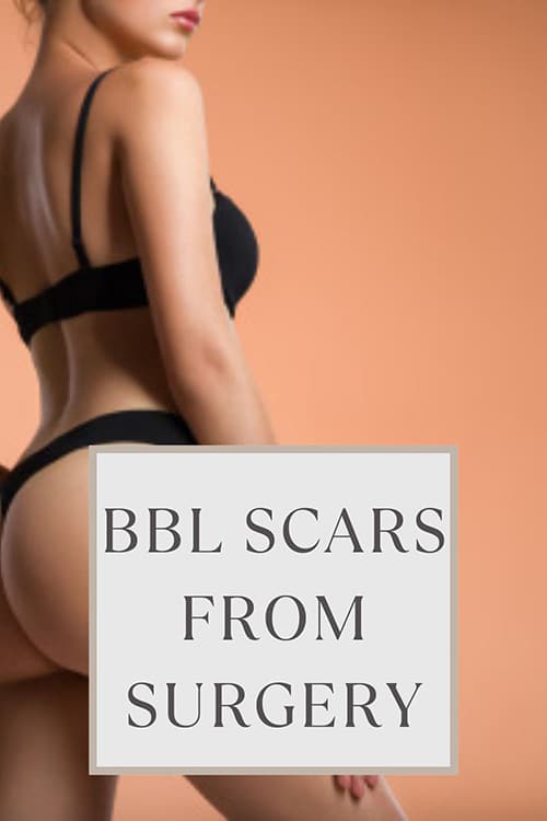 BBL Scars