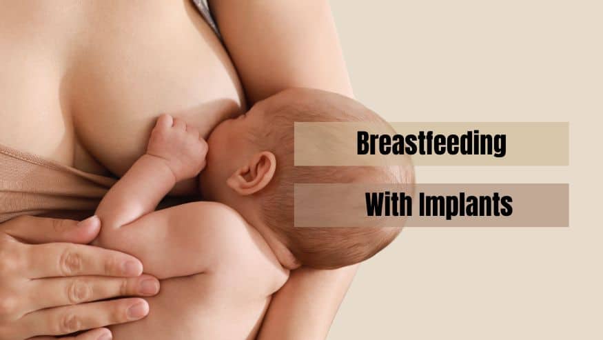 Breastfeeding With Implants