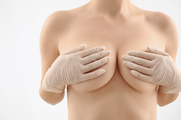 Fat Transfer Breast Fatgrafting Lipofilling - Review - RealSelf