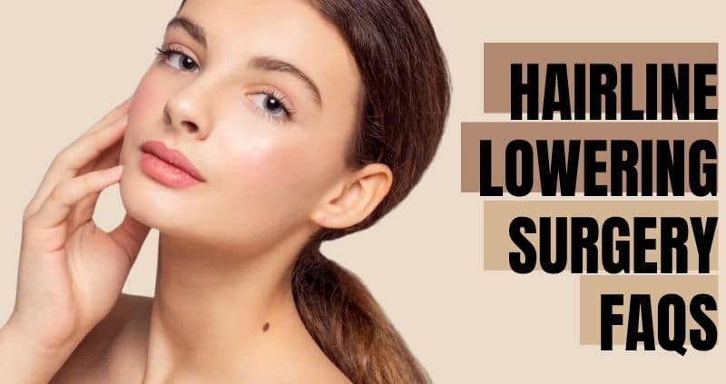 Hairline Lowering Surgery FAQs | Sieber Plastic Surgery