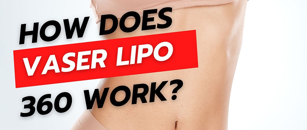 How Does Vaser Lipo 360 Work