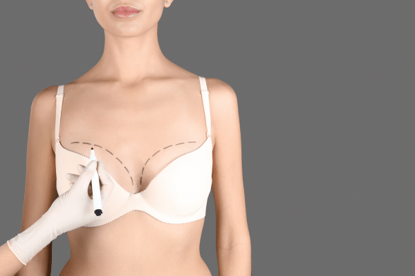 A Asymmetric breast enlargement within first trimester of