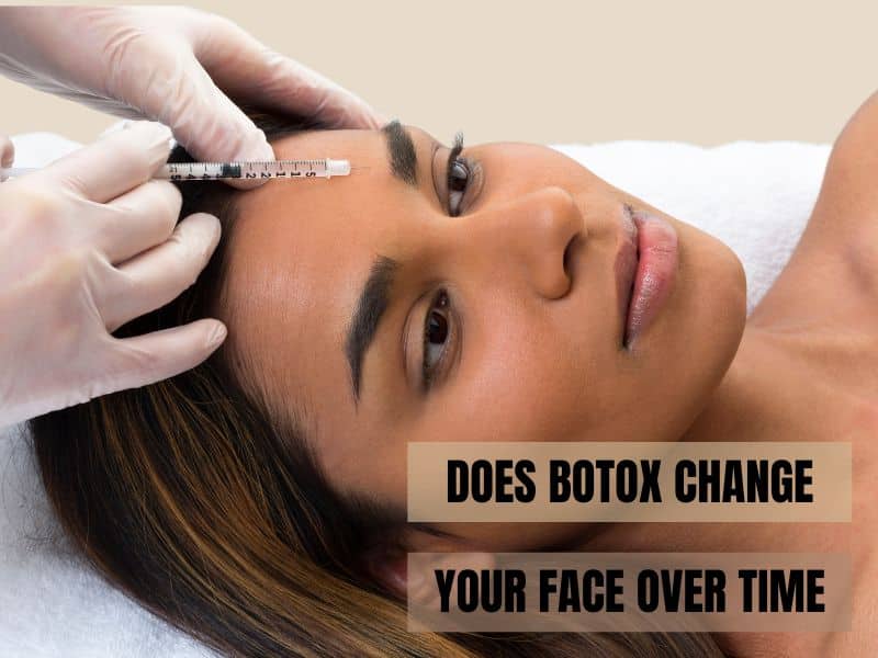 does botox change your face over time