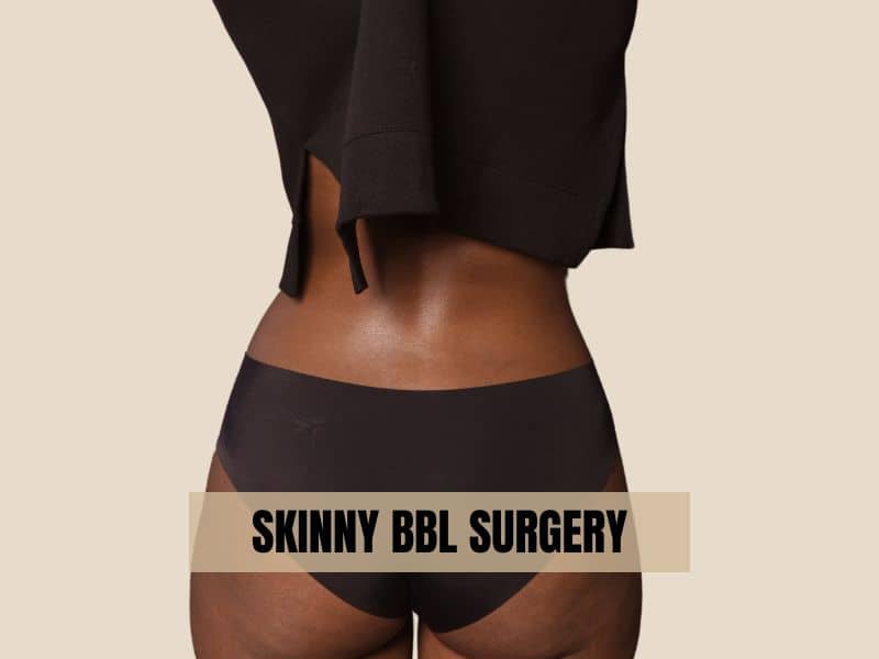 skinny bbl surgery